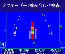 オクルーザー