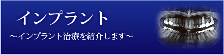 インプラント ～インプラント治療を紹介します