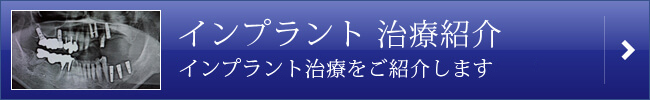 インプラント治療紹介