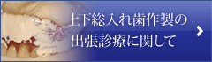 上下総入れ歯作製の出張診療に関して