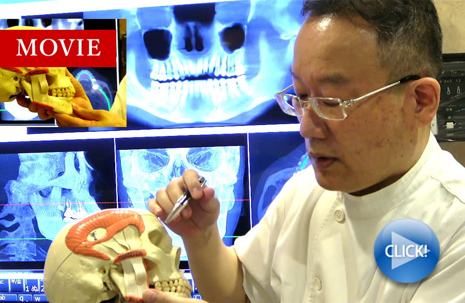 当医院の治療の流れについて Vol.1 院長による動画解説 「食べる時の顎の運動制御について」
